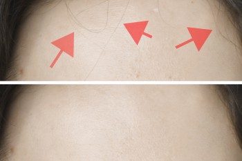 Einzelne Haarstränen auf homogener Fläche retuschieren
